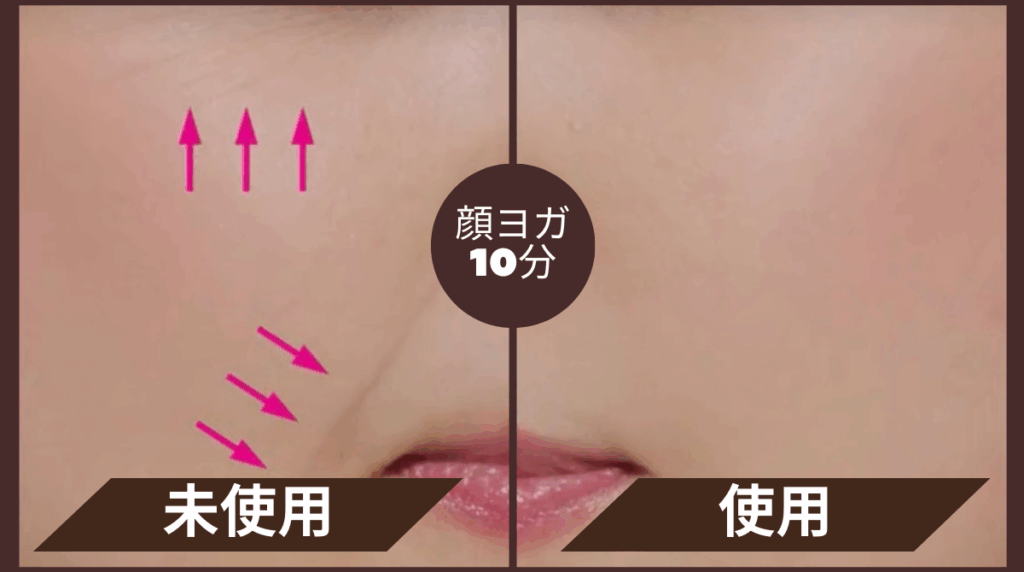 キープミスト効果